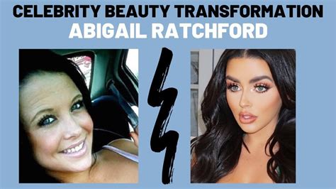 abigail ratchford before surgery